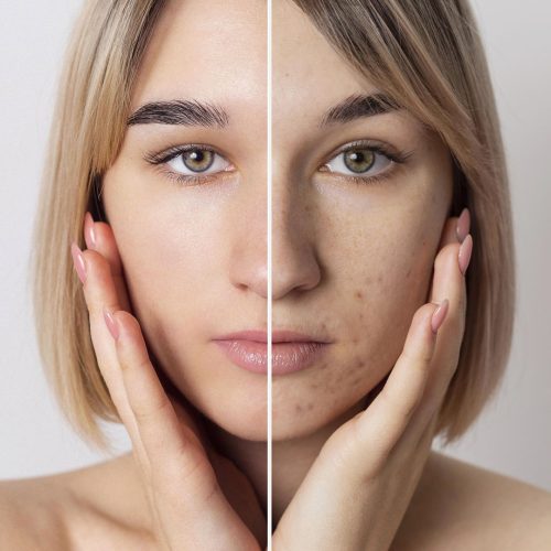 cildiye-dermatoloji-yetis-healths Cildiye