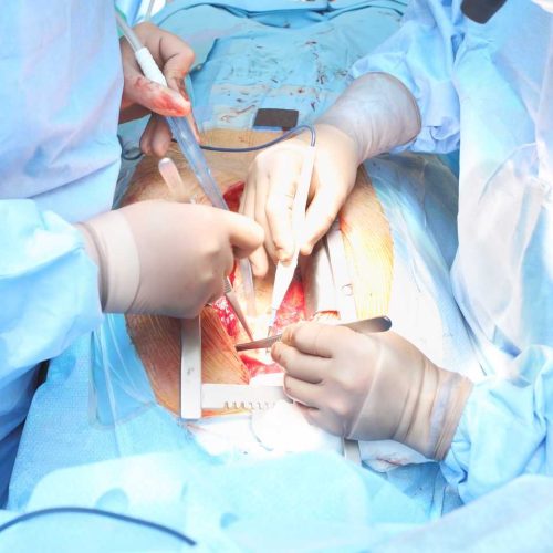 acik-kalp-ameliyati-4Yd31WNmQeatCU9ovWFK Kalp Damar Cerrahisi