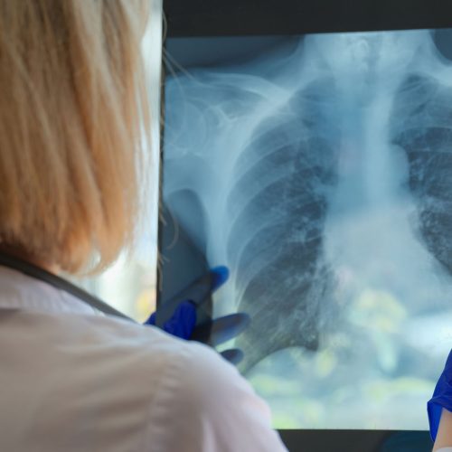 gogus-cerrahisi Göğüs Cerrahisi