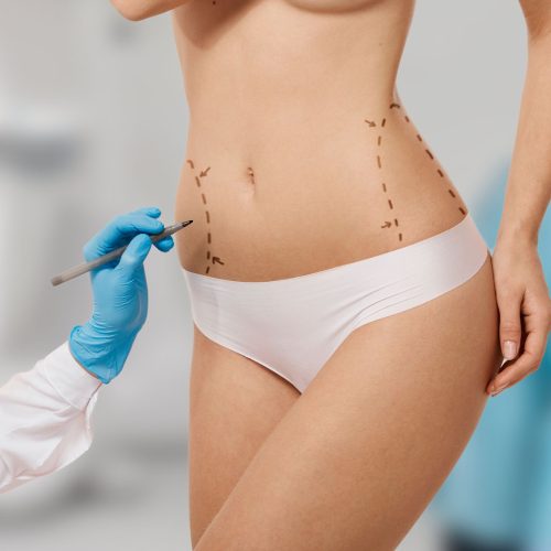 plastik-cerrahi-yetis-healths Plastik, Rekonstriktif ve Estetik Cerrahi