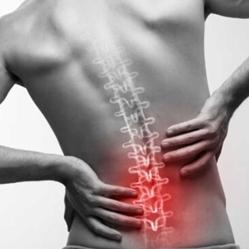 f662a2e7-0cbe-4d87-aa39-a57d37cbc4ec Bel Fıtığı Nedir?