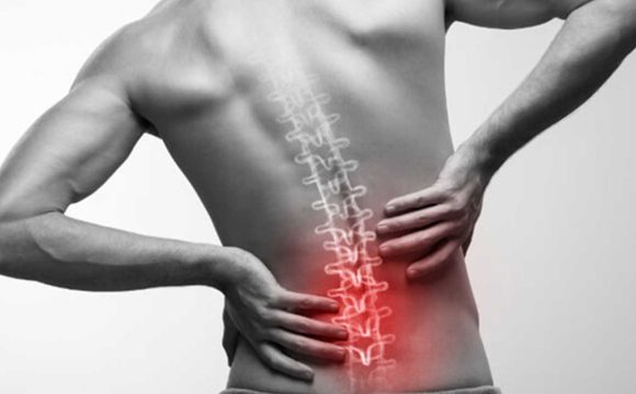 Bel Fıtığı Nedir?